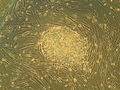 Stem cells.